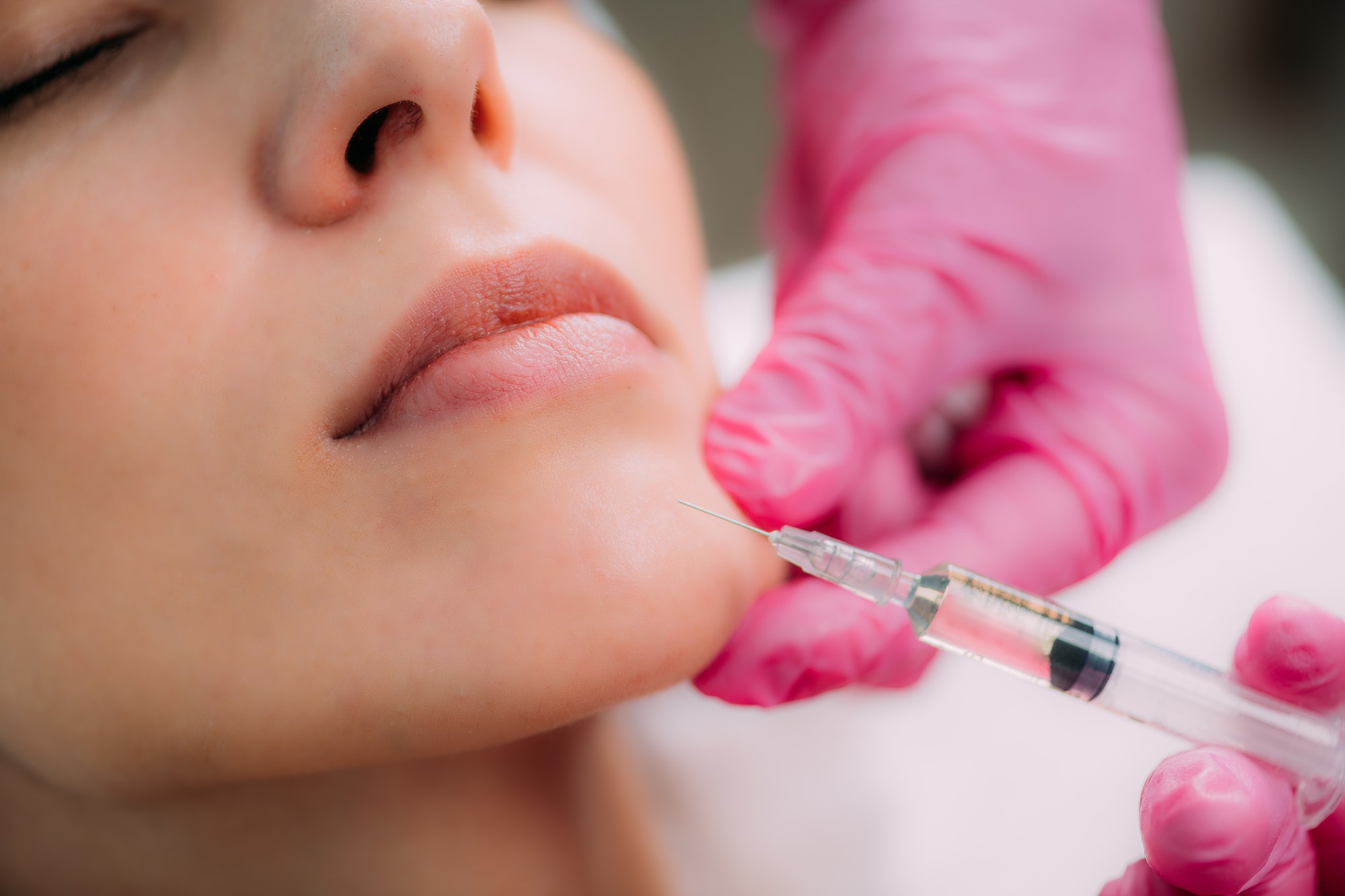 Liquid Facelift (Dermal Fillers + BTA Injection)