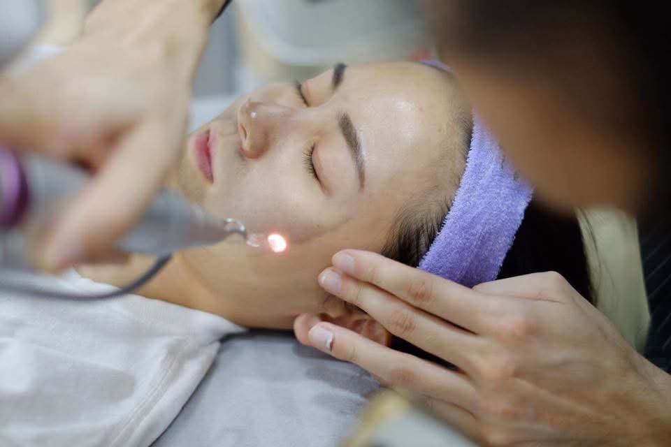 laser treatment