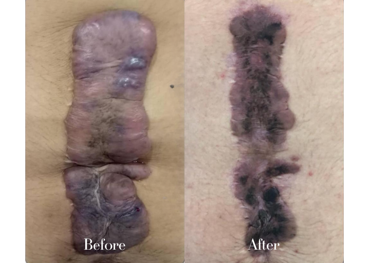 Before and After
