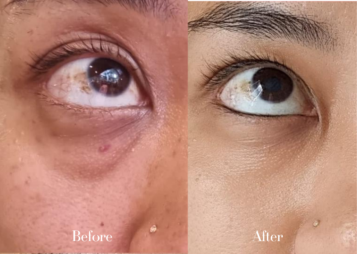 Before and After