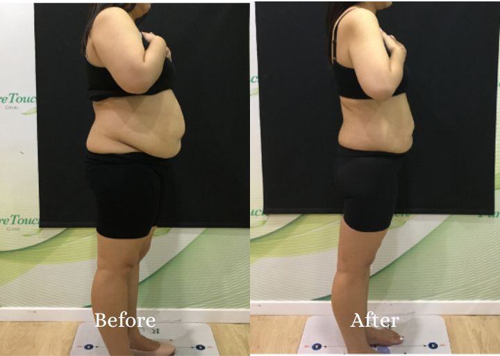 Metacode Slimming Result 3