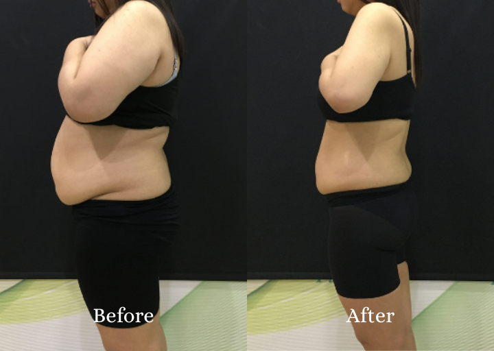 Metacode Slimming Result 1