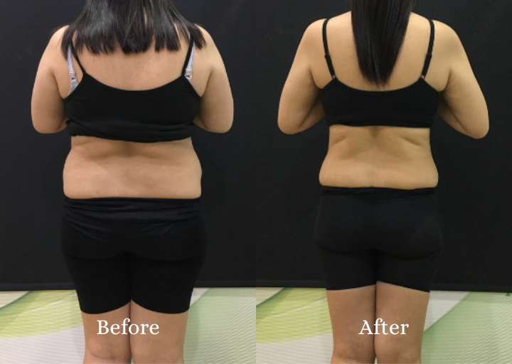 Metacode Slimming Result 2